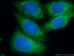 AGPAT9 Antibody in Immunocytochemistry (ICC/IF)