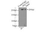 HECTD1 Antibody in Immunoprecipitation (IP)