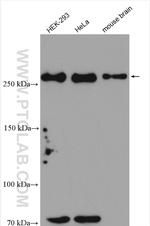 HECTD1 Antibody in Western Blot (WB)