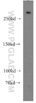 HECTD1 Antibody in Western Blot (WB)