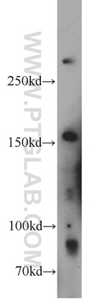 HECTD1 Antibody in Western Blot (WB)