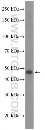 SLC37A4 Antibody in Western Blot (WB)