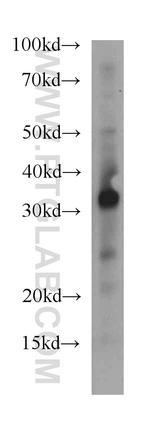 STC1 Antibody in Western Blot (WB)