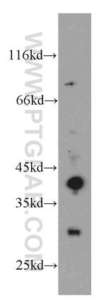 ABHD12B Antibody in Western Blot (WB)