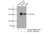 mDia1 Antibody in Immunoprecipitation (IP)