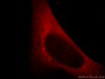 mDia1 Antibody in Immunocytochemistry (ICC/IF)