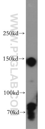 mDia1 Antibody in Western Blot (WB)