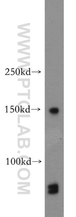 mDia1 Antibody in Western Blot (WB)