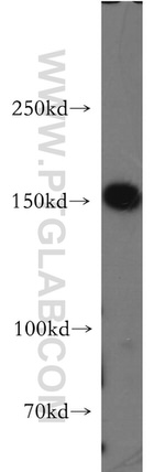 mDia1 Antibody in Western Blot (WB)