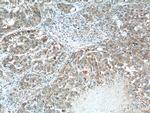 ZIP4 Antibody in Immunohistochemistry (Paraffin) (IHC (P))