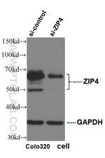 ZIP4 Antibody in Western Blot (WB)