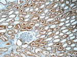 ZIP4 Antibody in Immunohistochemistry (Paraffin) (IHC (P))