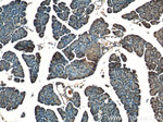 ZIP4 Antibody in Immunohistochemistry (Paraffin) (IHC (P))