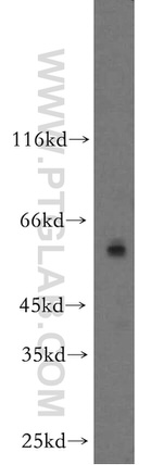 ZIP4 Antibody in Western Blot (WB)