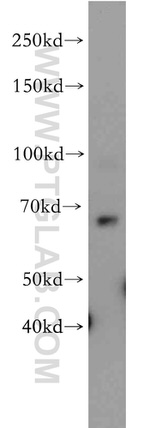 SLC22A15 Antibody in Western Blot (WB)