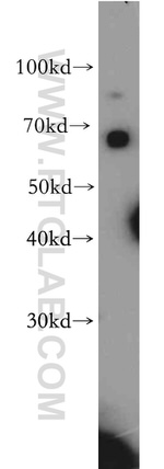 SLC22A15 Antibody in Western Blot (WB)