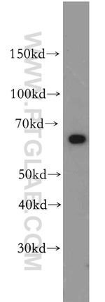 SLC22A15 Antibody in Western Blot (WB)