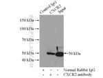 CXCR2 Antibody in Immunoprecipitation (IP)