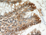 CXCR2 Antibody in Immunohistochemistry (Paraffin) (IHC (P))