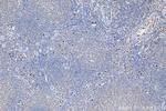 CXCR2 Antibody in Immunohistochemistry (Paraffin) (IHC (P))