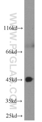 CXCR2 Antibody in Western Blot (WB)