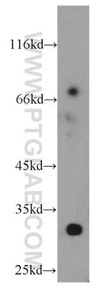 KIAA1191 Antibody in Western Blot (WB)