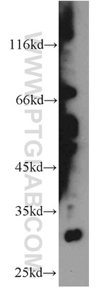 KIAA1191 Antibody in Western Blot (WB)