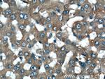 Fibrinogen alpha chain Antibody in Immunohistochemistry (Paraffin) (IHC (P))