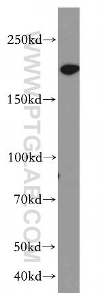 SMARCA4/BRG1 Antibody in Western Blot (WB)