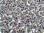 SMARCB1 Antibody in Immunohistochemistry (Paraffin) (IHC (P))