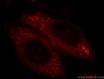 MARCKS Antibody in Immunocytochemistry (ICC/IF)