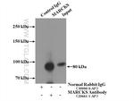 MARCKS Antibody in Immunoprecipitation (IP)