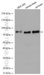 MARCKS Antibody in Western Blot (WB)