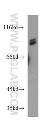 MARCKS Antibody in Western Blot (WB)