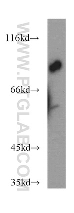 MARCKS Antibody in Western Blot (WB)