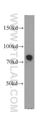 MARCKS Antibody in Western Blot (WB)