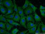 NF-M Antibody in Immunocytochemistry (ICC/IF)