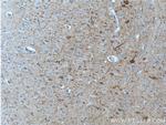 NF-M Antibody in Immunohistochemistry (Paraffin) (IHC (P))