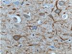 NF-M Antibody in Immunohistochemistry (Paraffin) (IHC (P))