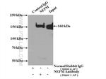 NF-M Antibody in Immunoprecipitation (IP)