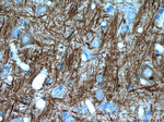 NF-M Antibody in Immunohistochemistry (Paraffin) (IHC (P))