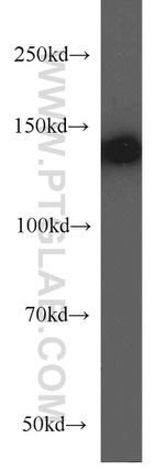 NF-M Antibody in Western Blot (WB)