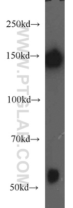 NF-M Antibody in Western Blot (WB)