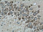 PSD95/DLG4 Antibody in Immunohistochemistry (Paraffin) (IHC (P))