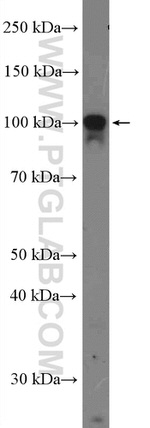 PSD95/DLG4 Antibody in Western Blot (WB)