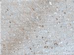 CaMKII delta Antibody in Immunohistochemistry (Paraffin) (IHC (P))