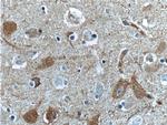 CaMKII delta Antibody in Immunohistochemistry (Paraffin) (IHC (P))