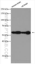 CaMKII delta Antibody in Western Blot (WB)