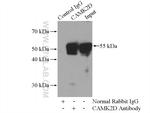 CaMKII delta Antibody in Immunoprecipitation (IP)