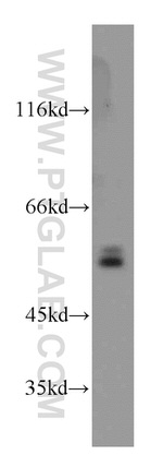 CaMKII delta Antibody in Western Blot (WB)